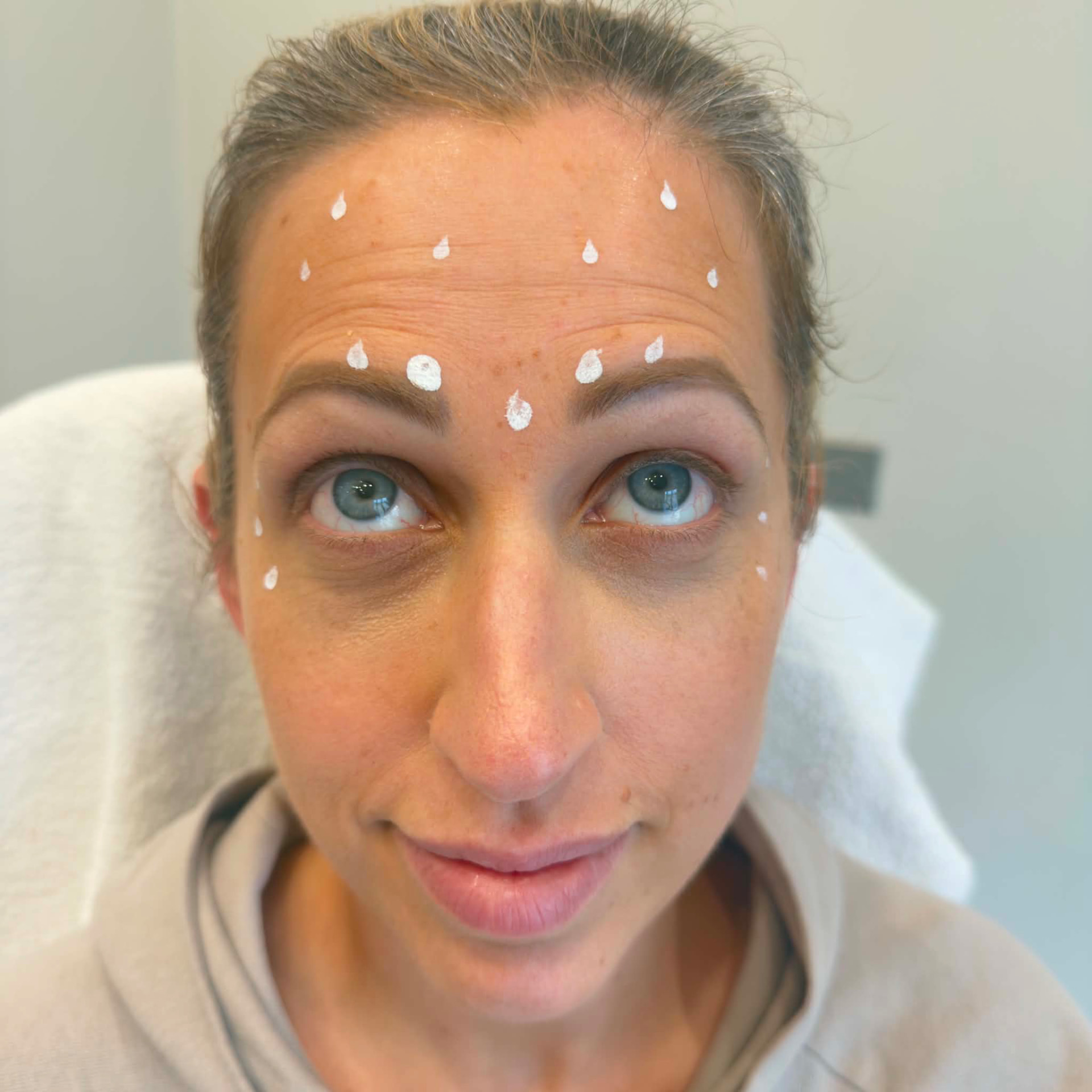 Before treatment